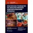 russische bücher: Сесил Том - Практическое руководство по злокачественным новообразованиям брюшины