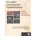 russische bücher: Румболдт З. - КТ- и МРТ- визуализация головного мозга. Подход на основе изображений