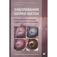 russische bücher: Овсянникова Т.В., И.А.Куликов, С.В.Павлович - Заболевания шейки матки. Современные подходы к диагностике и лечению