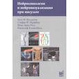 russische bücher: Вальдуэза Х.М., Шрайбер С.Й., Рёль Й.-Э., Клингеби - Нейросонология и нейровизуализация при инсульте