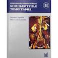 russische bücher: Галански  Михель, Прокоп Матиас - Спиральная и многослойная компьютерная томография