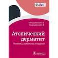 russische bücher: Матушевская Елена Владиславовна - Атопический дерматит Генетика, патогенез и терапия