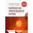 russische bücher: Иойлева Е.Э. и др. - Патология зрительного нерва