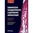 russische bücher: Ланг Николаус П. - Клиническая пародонтология и дентальная имплантация. В 2-х томах. Том 2