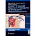 russische bücher: Барольд С.,Штрубандт С.,Синнейв А - Иллюстрированное пошаговое руководство по применению кардиостимуляторов