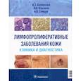 russische bücher: Белоусова Ирена Эдуардовна - Лимфопролиферативные заболеванания кожи. Клиника и диагностика