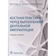 russische bücher: Лосев Ф.,Кулаков А.,Брайловская Т. - Костная пластика перед выполнением дентальной имплантацией