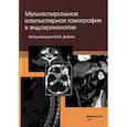 russische bücher: Под ред. Дедова И.И. - Мультиспиральная компьютерная томография в эндокринологии