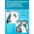 russische bücher: Хофер Матиас - Рентгенологическое исследование грудной клетки. Практическое руководство. Атлас