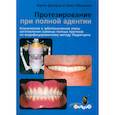 russische bücher:  - Протезирование при полной адентии. Клинические и зуботехнические этапы изготовления съемных полных протезов по модифицир