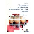 russische bücher: Марк Бер. - Устранение осложнений имплантологического лечения