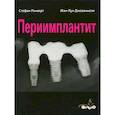 russische bücher: Стефан Ренверт, Жан-Луи Джованьоли - Периимплантит