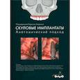 russische bücher: под ред. К. Апарисио - Скуловые имплантаты. Анатомический подход