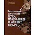 russische bücher: Под ред. Труфанова Г.Е. - Визуализация заболеваний почек, мочеточников и мочевого пузыря. Учебное пособие