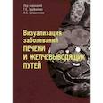 russische bücher: Под ред. Труфанова Г.Е. - Визуализация заболевантй печени и желчевыводящих путей. Учебное пособие