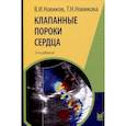 russische bücher: Новиков В.И., Новикова Т.Н. - Клапанные пороки сердца