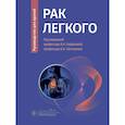 russische bücher: под ред.Горбуновой В.,Лактионова К. - Рак легкого
