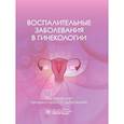 russische bücher: Дубровина С.О., Ардинцева О.А., Белокриницкая Т.Е. и др. - Воспалительные заболевания в гинекологии