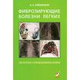 russische bücher: Сперанская А.А. - Фиброзирующие болезни легких. Роль рентгенолога в мультидисциплинарном консилиуме
