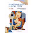 russische bücher: Под ред. Абильдиновой Г.Ж. - Врожденные пороки развития плода: атлас