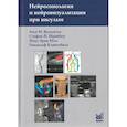 russische bücher: Вальдуэза Х.М., Шрайбер С.Й. - Нейросонология и нейровизуализация при инсульте