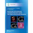 russische bücher: Криворотько П.В. - Биопсия сигнальных лимфатических узлов при раке молочной железы