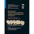russische bücher: Бруна Э., Смитсон Д., Фабианелли А. - Вертикальное препарирование зубов под несъемные ортопедические конструкции