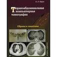 russische bücher: Юдин А.Л. - Торакоабдоминальная компьютерная томография. Образы и симптомы