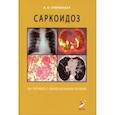 russische bücher: Сперанская А.А. - Саркоидоз. Роль ренгенолога в мультидисциплинарном консилиуме
