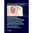 russische bücher: Штрубандт Р., Барольд С., Синнейв А. - Имплантируемые кардиовертеры-дефибрилляторы. Иллюстрированное пошаговое руководство