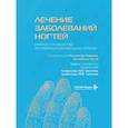 russische bücher: Под ред. Чиаккио Н.Ди., Тости А. - Лечение заболеваний ногтей. Краткое руководство по современным методам терапии