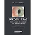 russische bücher: Бойко Э.В., Черныш В.Ф. - Ожоги глаз. Состояние проблемы и новые подходы
