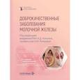 russische bücher: Под ред. Каприна А.Д., Рожковой Н.И. - Доброкачественные заболевания молочной железы