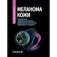 russische bücher: Под ред. Беляева А.М., Семиглазова В.В. - Меланома кожи: руководство для врачей