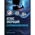 russische bücher: Крюков А.И., Носуля Е.В., Кунельская Н.Л. и др. - Атлас операций в оториноларингологии