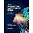 russische bücher: Под ред. Таня Ч., Чжу В. - Атлас пигментных заболеваний кожи