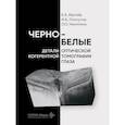 russische bücher: Лоскутов И.А., Ивачев Е.А., Никитина Л.О. - Черно-белые детали оптической когерентной томографии глаза