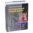 russische bücher: Розадо-де-Кристенсон Мелисса Л., Картер Бретт В. - Лучевая диагностика. Опухоли органов грудной клетки