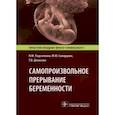russische bücher: Подзолкова Н.,Скворцова М.,Денисова Т. - Самопроизвольное прерывание беременности. Современные подходы к диагностике, лечению и профилактике