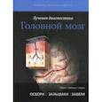 russische bücher: Осборн Анна Г., Зальцман Карен Л., Завери Миралти Д. - Лучевая диагностика. Головной мозг
