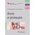 russische bücher: Матушевская Е., Свирщевская Е. - Акне и розацеа