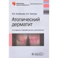 russische bücher: Альбанова Вера Игоревна - Атопический дерматит