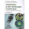 russische bücher: Зимина В.,Кравченко А.,и др. - Туберкулез и ВИЧ-инфекция у взрослых.Руководство