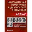 russische bücher: под ред.Труфанова Г.,Грищенкова А. - Компьютерная томография в диагностике пневмоний