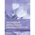 russische bücher: Мале Ж. - Наглядная дентальная имплантология