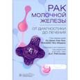 russische bücher: Агияр Фернандо Налессо - Рак молочной железы. От диагностики до лечения