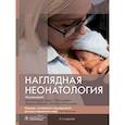russische bücher: под.ред.Лиссауэ - Наглядная неонатология